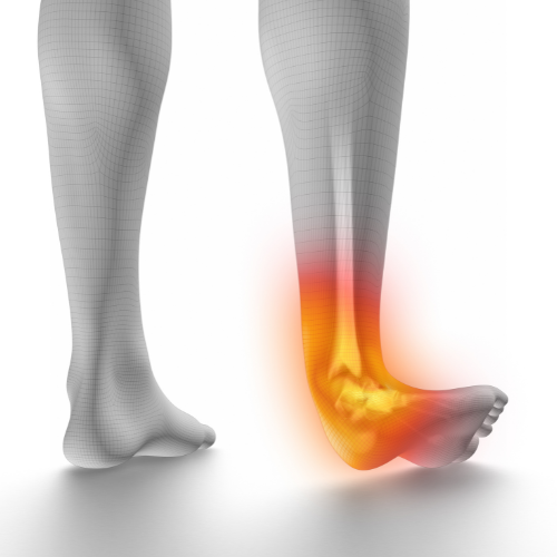 Ankle Sprain Symptoms: Pain, Swelling and Bruising Explained by an Orthopedic Specialist